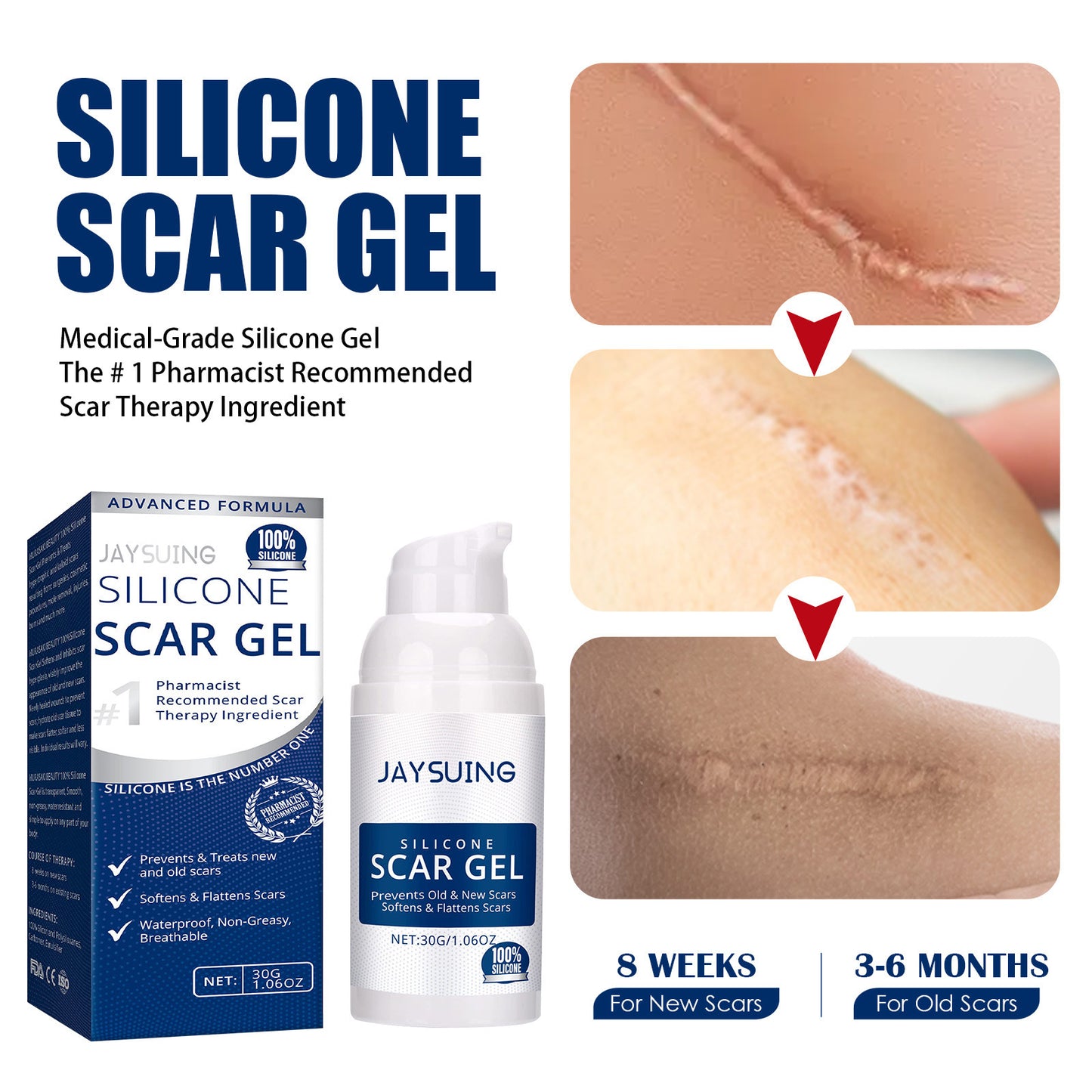 Scar Repairing Gel Reduces Pregnancy